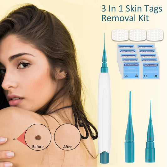 New 3 IN 1 Auto Skin Tag Remover